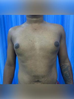 Pre Operation X-ray